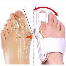 Thumb Valgus Toe Male And Female Corrector