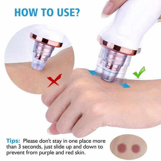 Pore Cleaning Device